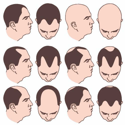 Identify Hair & Scalp Problems - TK TrichoKare | TK TrichoKare
