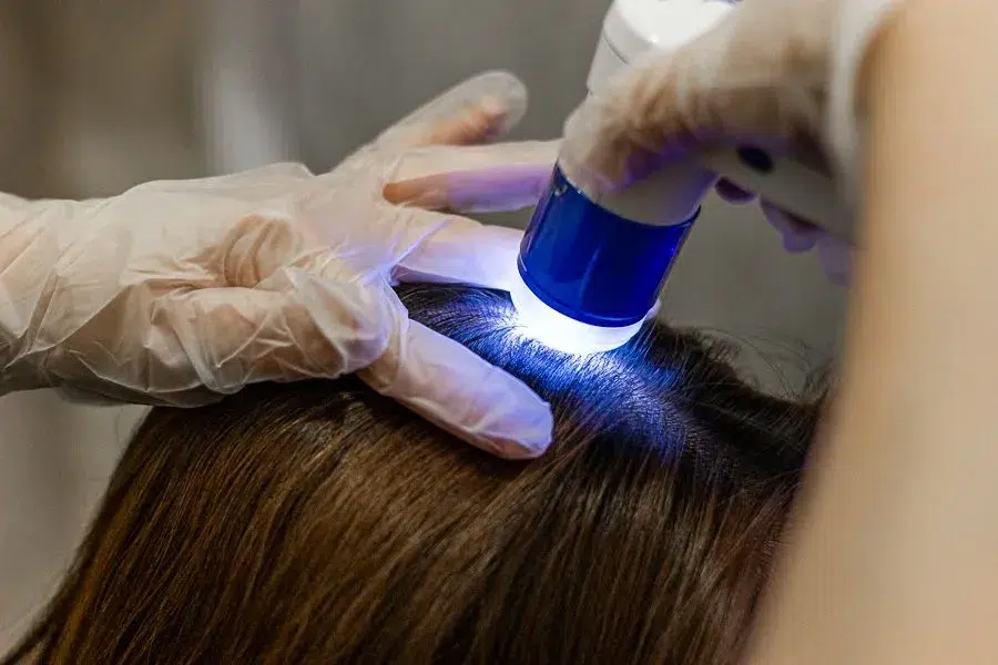 Step 6 Intensive Scalp Nourishment Treatment at TK TrichoKare Singapore